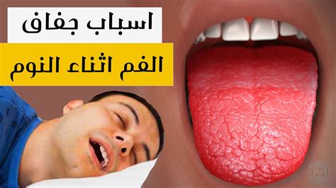 اسباب جفاف الفم اثناء النوم